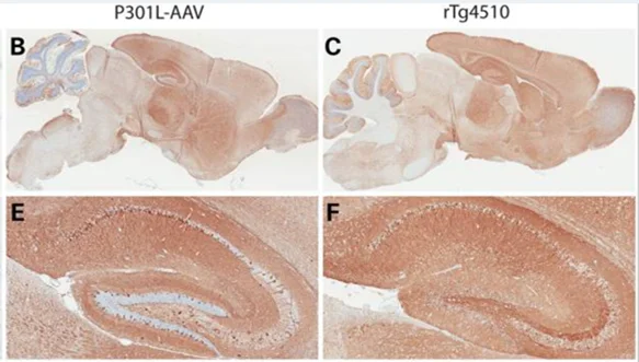 Human tau expression in Tau FTD animal models